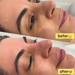 خدمات تخصصی پوست (فیشیالیست رویا صالحی)