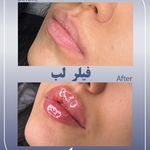 کلینیک زیبایی و لیزر سلن مشهد