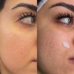 فرناز سعادت خدمات تخصصی فیشال و ریموو