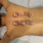 کلینیک فیزیوتراپی آذر