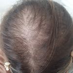 فیشیال و پاکسازی صورت مژگان