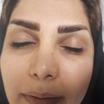 فیشیال و پاکسازی صورت مژگان