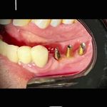 کلینیک دندانپزشکی،ایمپلنت دکترالهه صادقی
