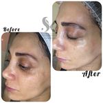 خدمات تخصصی فیشال سارا اسکین بار