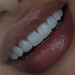 کلینیک تخصصی دندانپزشکی آلفا(بیمه داریم)