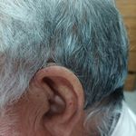 شنوایی سنجی و سمعک آوانا