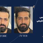 کلینیک زیبایی آرا مهر