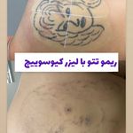 کلینیک لیزر و زیبایی دایان