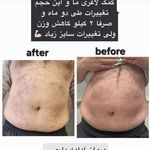 مرکز زیبایی و لاغری روژه