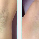 کلینیک زیبایی،مرکز لیزر الکساندرایت تاژا