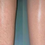 کلینیک زیبایی،مرکز لیزر الکساندرایت تاژا