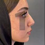 کلینیک زیبایی،مرکز لیزر الکساندرایت تاژا