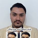 کلینیک لیزر و زیبایی سنسو
