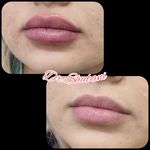 کلینیک پوست مو لیزر و لاغری عصر زیبایی