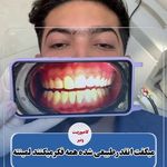 دندانپزشکی دکتر راحله لطفعلی-بیمه نداریم