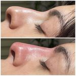 کلینیک پوست وزیبایی ومرکز تخصصی فیلربادی