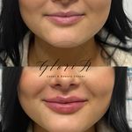 کلینیک زیبایی گلوریا