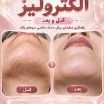 مرکز لیرز و جوانسازی پوست شهربانو