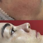فیشال و خدمات پاکسازی پوست  فاطمه انامی