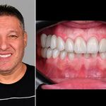 دندانپزشکی دیجیتال ونک دنتال