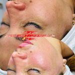 کلینیک فیشال و ماساژ سارن اسکین سارا