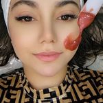 آموزش وخدمات فیشال .پرسینگ.خال نیلماه