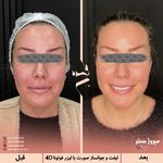 مرکز پزشکی و زیبایی میروژ سنتر