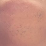 مرکز تخصصی الکترولیز و فیشیال گلها(ویژه بانوان)