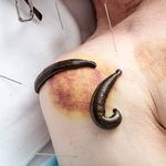 طب سنتی الف