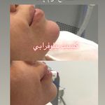 کلینیک پوست و مو و لیزر نیلوفر آبی