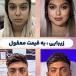 کلینیک پوست،مو،زیبایی،مرکز لیزر ‌پرنسا