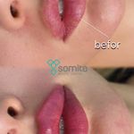 کلینیک پوست ،مو و زیبایی سمیتا