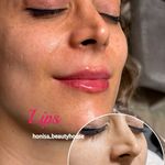 کلینیک زیبایی و مرکز لیزر هانیسا