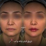 مطب پوست زيبايی ليزر دکتر شاه نعمت الهی
