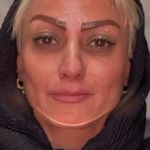 کلینیک زیبایی پوست و لیزر بلاریا