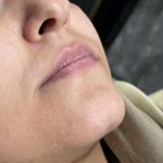 کلینیک زیبایی پوست و لیزر بلاریا
