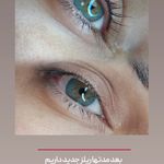 تتو و ریموو تتو درسا