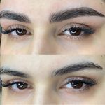 مرکز تخصصی فیبروز ابرو مژگان خناری