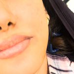 کلینیک زیبایی و لیزر لوتوس