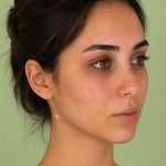 کلینیک زیبایی و لیزر لوتوس