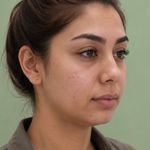کلینیک زیبایی و لیزر لوتوس