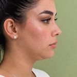 کلینیک زیبایی و لیزر لوتوس