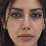 کلینیک زیبایی و لیزر لوتوس
