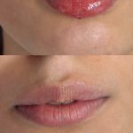 کلینیک زیبایی و لیزر لوتوس