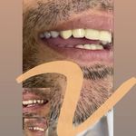 دندانسازی تخصصی طاهریان