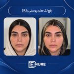 مرکز تخصصی زیبایی و جوانسازی دمور