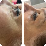 جوانسازی و فیشال پوست خدارحمی