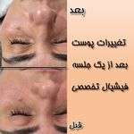 مرکز لیزر و فیشال دکتر خالقیان