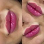 کلینیک پوست و مو و لیزر پاپیون