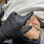 کلینیک زیبایی، فیشال امینی